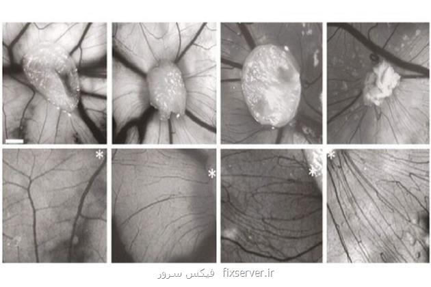 آیا ریشه اختلال اسکیزوفرنی در مغز است؟