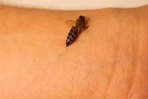 چرا نیش زنبور تا این حد دردناک است؟