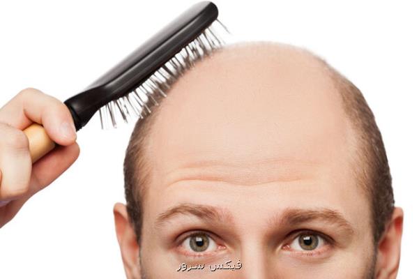 سیستم لنفاوی در رویش مو تاثیر دارد