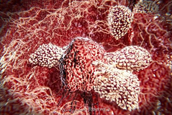 سلول های ایمنی چگونه از خود در مقابل تومور سرطانی محافظت می كنند؟