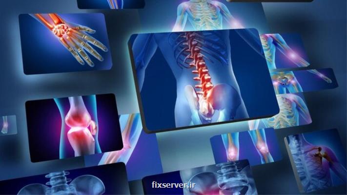 استفاده از داروی سرطان برای بیماری های التهابی